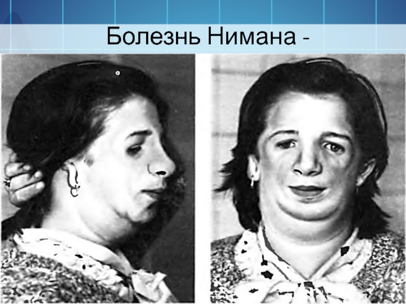 День болезни Нимана–Пика