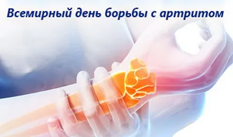 История Всемирного дня борьбы с артритом
