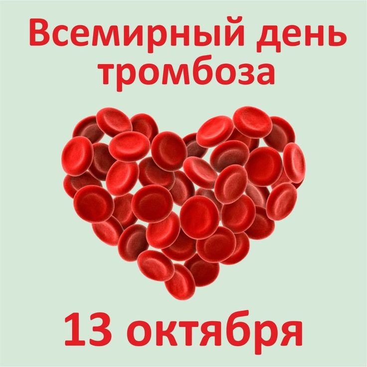 Всемирный день борьбы с тромбозом Что такое тромбоз
